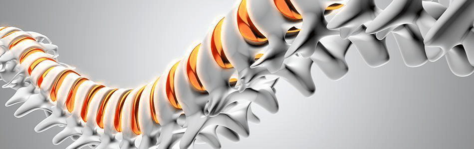 DISKOM — инструмент для перкутанной механической резекции пульпозного ядра межпозвонкового диска