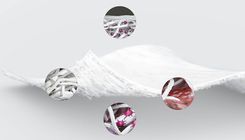 Chondro-Gide — коллагеновая матрица для восстановления хрящевой ткани по методу AMIC