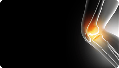 JointRep — инъекционный имплант для лечения хондральных повреждений синовиальных суставов